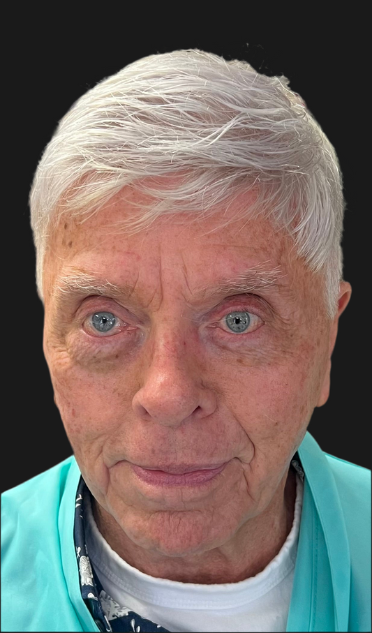 Hair replacement service